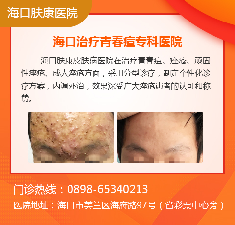 皮肤长痘痘的原因是什么,为什么会长痘痘?